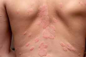 Could be a sign of kidney disease