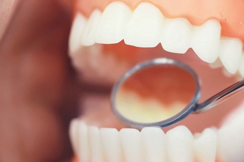 7 dental health rules